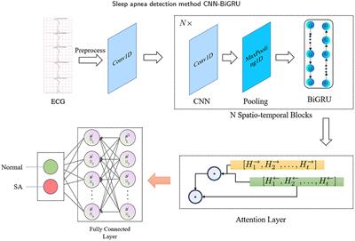 A spatio-temporal learning-based model for sleep apnea detection using single-lead ECG signals